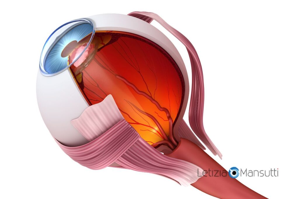tipi di glaucoma